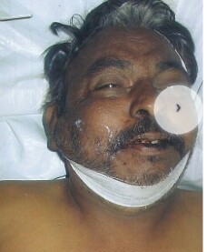 Found Person Image