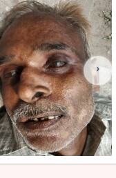Found Person Image
