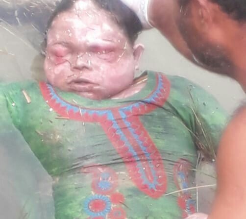 Found Person Image