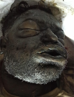Found Person Image